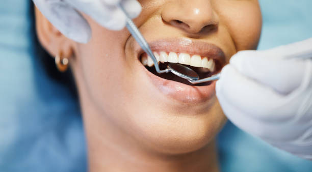 Best Root Canal Emergency Dentist  in Keasbey, NJ